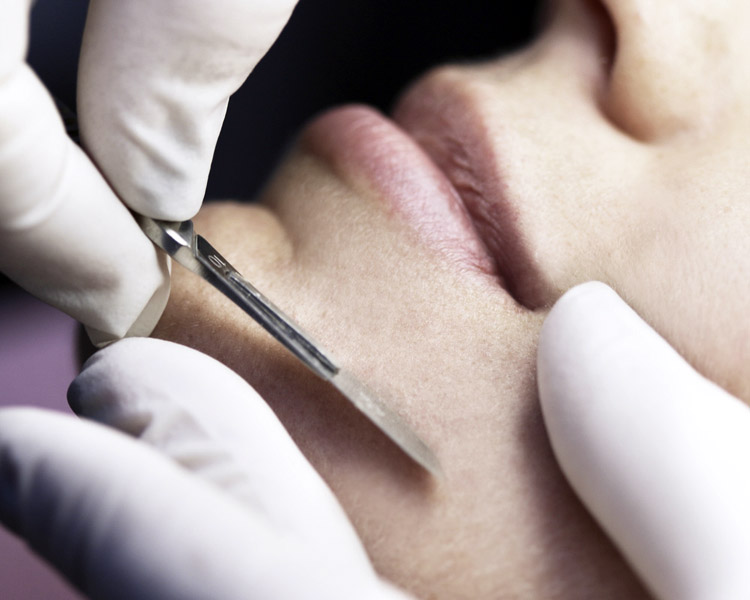 dermatolog-zabiegi-dermatochirurgia-1