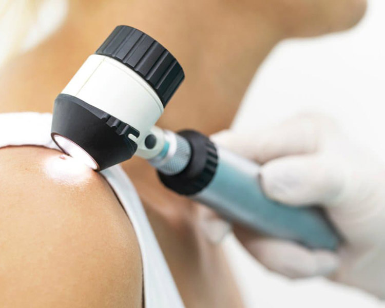 dermatolog-zabiegi-dermatochirurgia-2