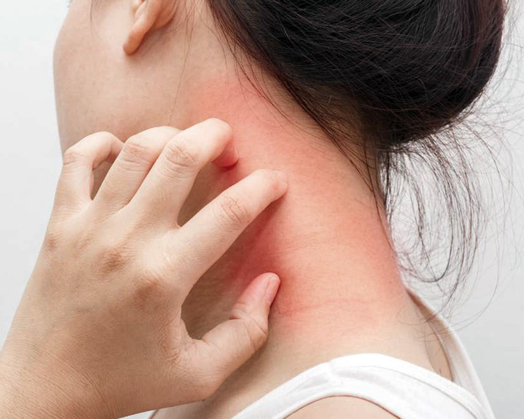 dermatolog-leczenie-egzema