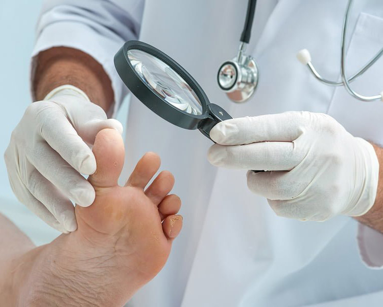 dermatolog-leczenie-grzybica-paznokci