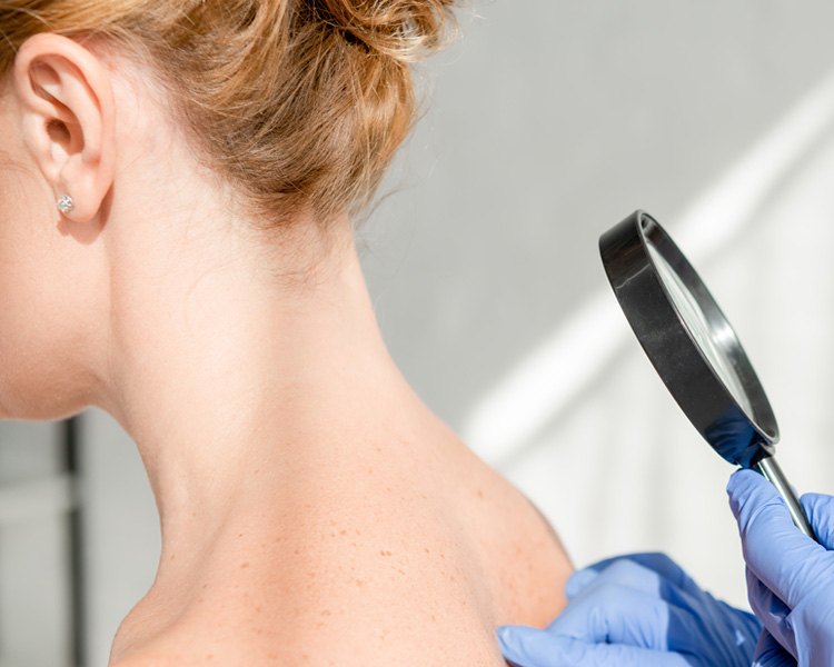 dermatolog-zabiegi-1 dermatolog-zabiegi-1