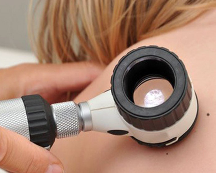 dermatolog-zabiegi-badanie-znamion-1