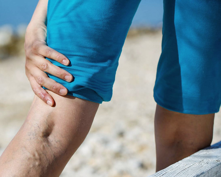 dermatolog-zabiegi-skleroterapia-2